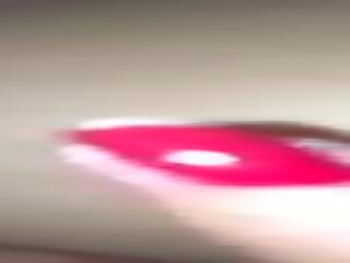 Bitten 由 該 buggery bug